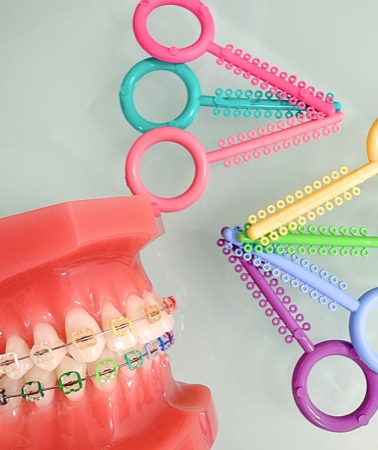 矯正治療中も"かわいく・楽しく”